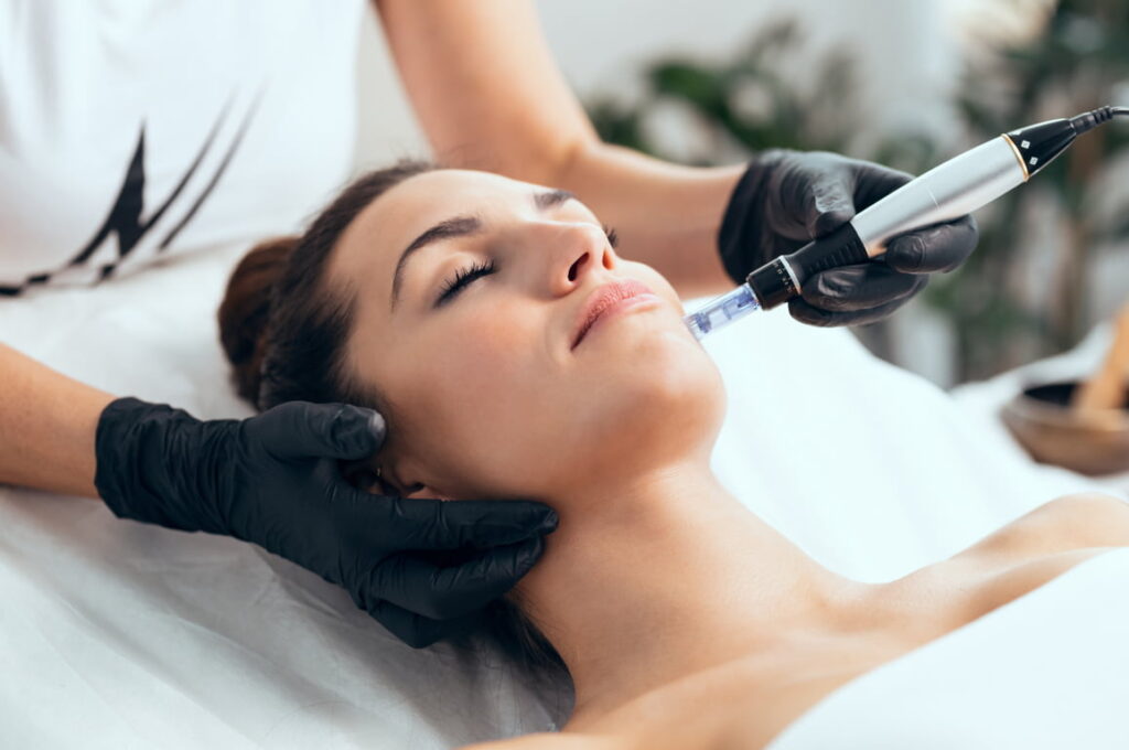 Microneedling