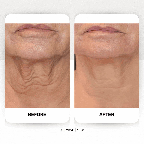 throat
